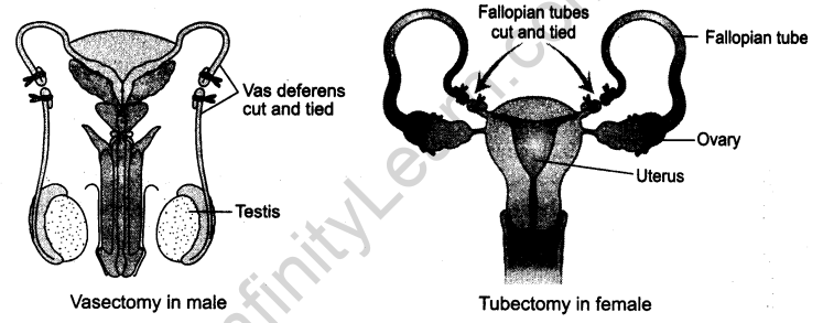 reproductive-health-cbse-notes-class-12-biology-1