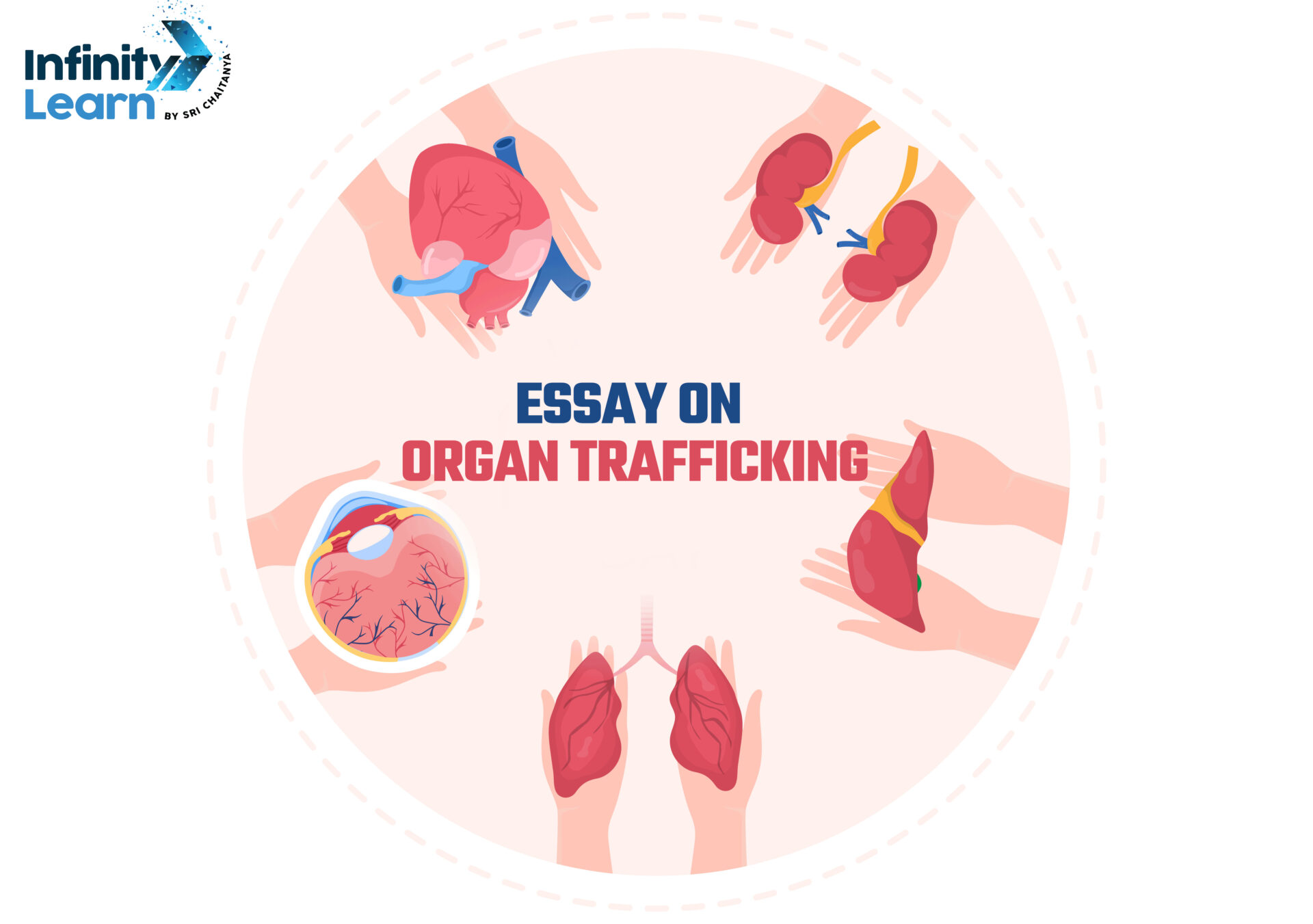Essay on Organ Trafficking