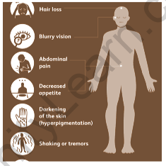 Addison’s disease