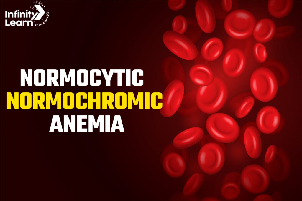 Normocytic Normochromic Amenia: Causes, Symptoms & Treatment